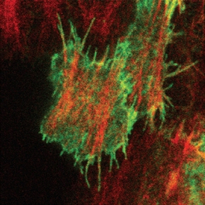 Vue basale des cellules clones co-exprimant mCD8GFP (en vert) et moeABD-mCherry (en rouge), montrant que les filopodes rayonnent à partir du réseau de fibres de stress médial-basal